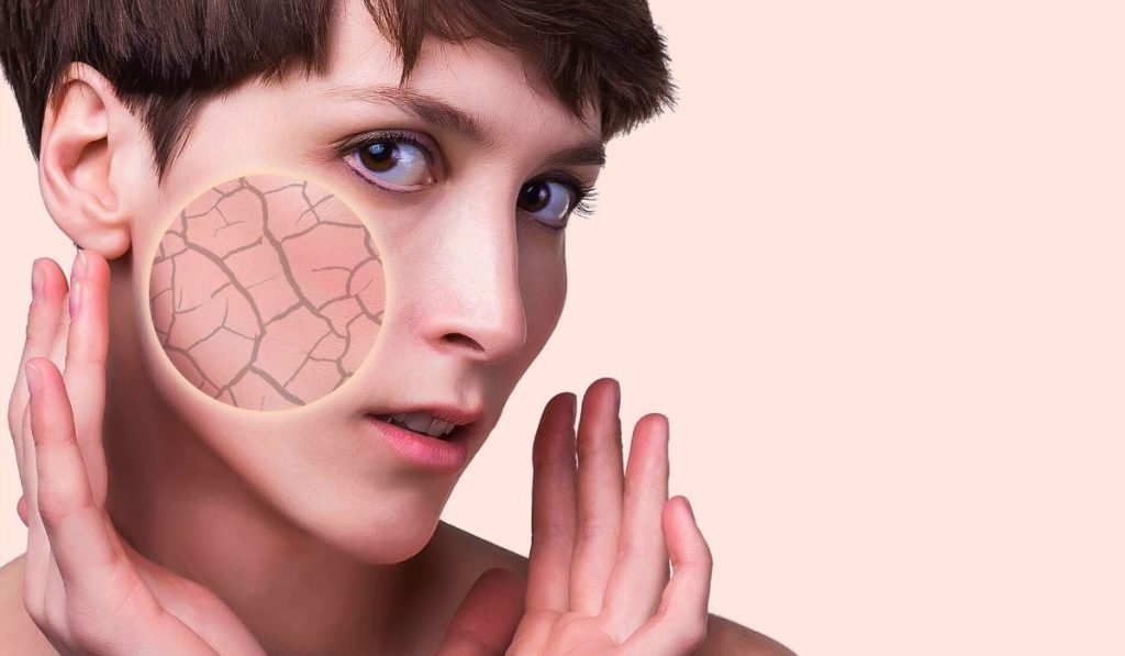 How-to-Get-Rid-of-Pimples-4-2